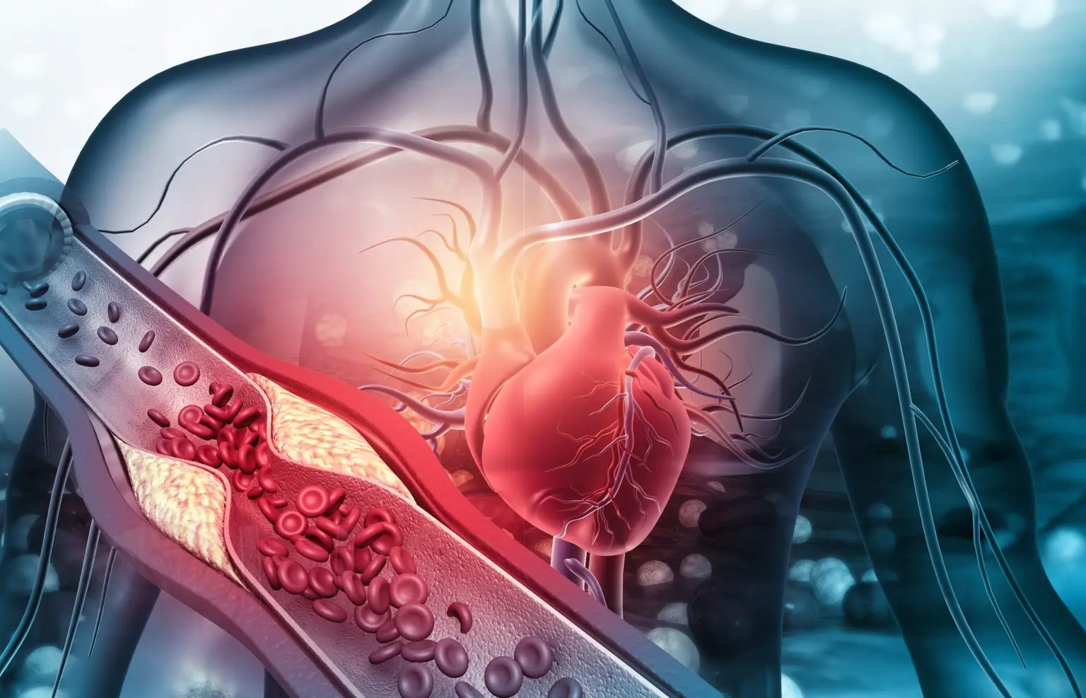 Infarto e ischemia: quali sono le differenze e perché è importante riconoscerle per la salute del cuore?
