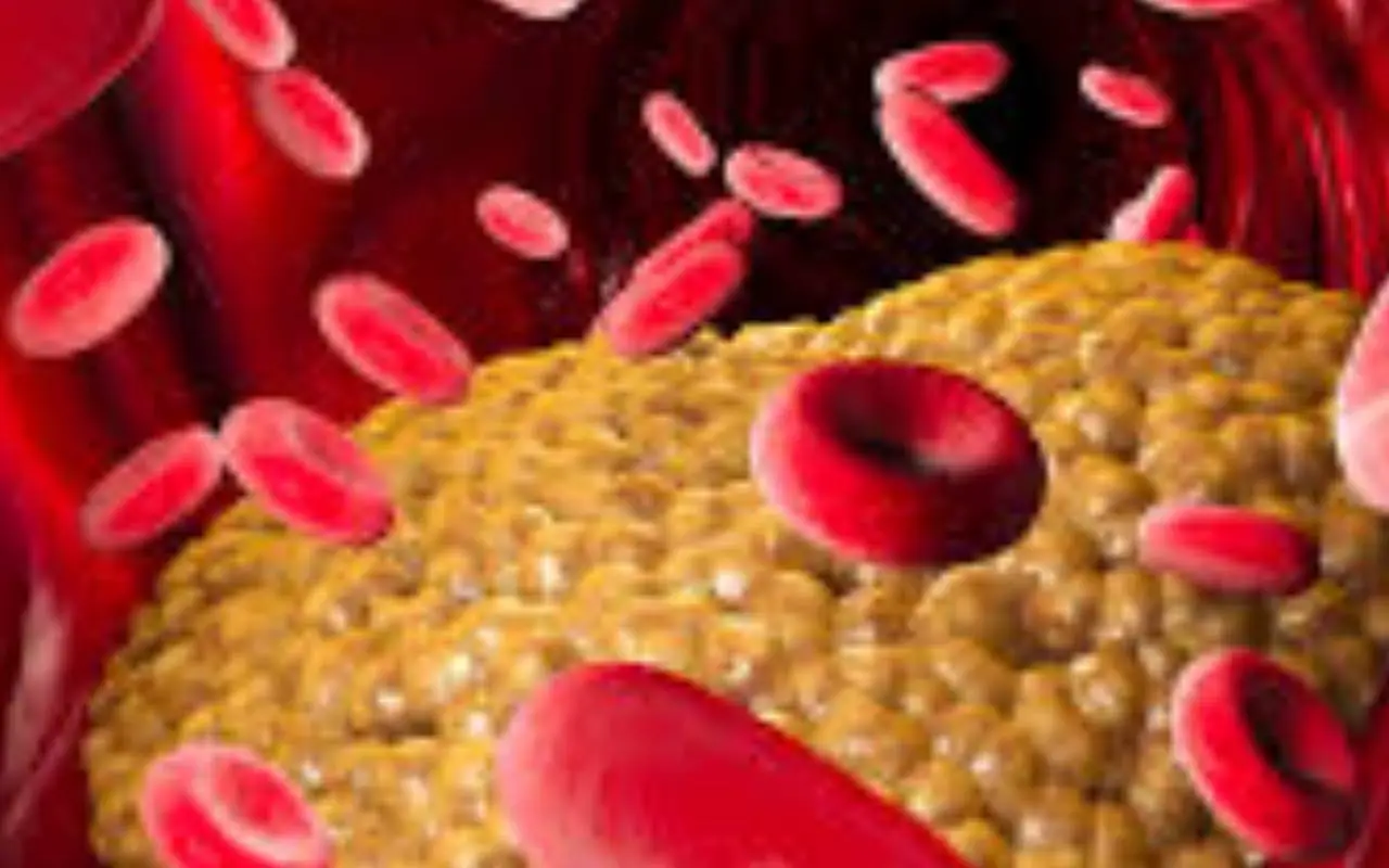 Non basta il colesterolo: ecco quali sono i valori davvero indicano il rischio infarto e ictus